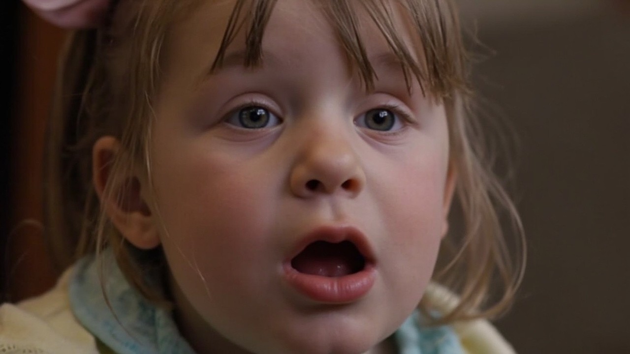 Girl with Cleft Lip Speaking Unclearly